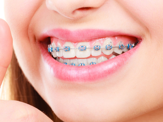 brackets