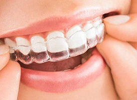 Invisalign - HC Odontologos - clinica dental en merida