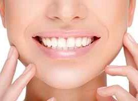 Limpieza Dental Merida - HC Odontologos - Clinica Dental Merida