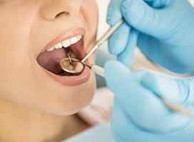 Resinas Dentales - HC Odontologos - Clinica Dental Merida