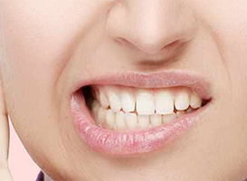 trastornos temporomandibulares - hc odontologos - clinica dental merida