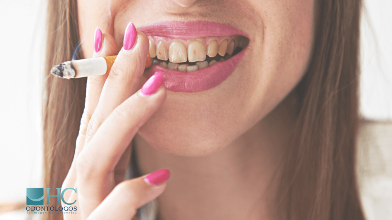 Los efectos del tabaco en los dientes - HC Odontólogos | Clínica Dental en Mérida Yucatán