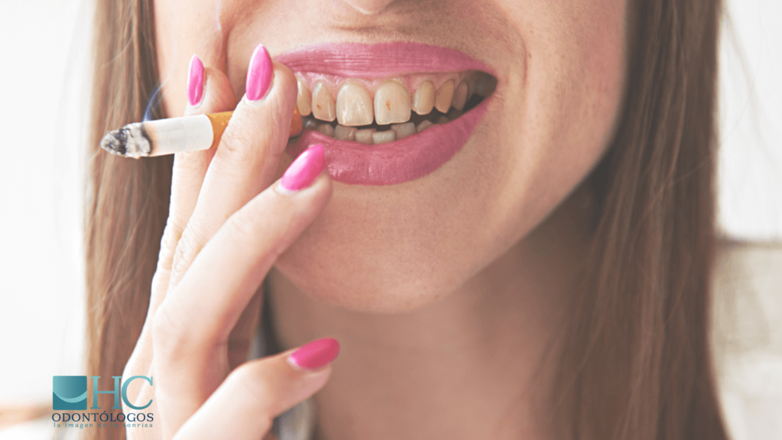 Los efectos del tabaco en los dientes - HC Odontólogos | Clínica Dental en Mérida Yucatán