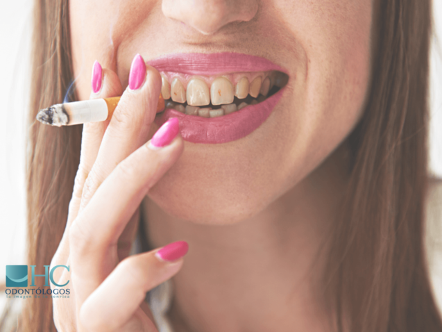 Los efectos del tabaco en los dientes - HC Odontólogos | Clínica Dental en Mérida Yucatán