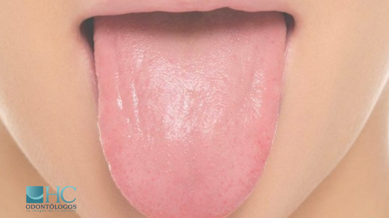 HC Odontólogos | Clínica Dental en Mérida Yucatán