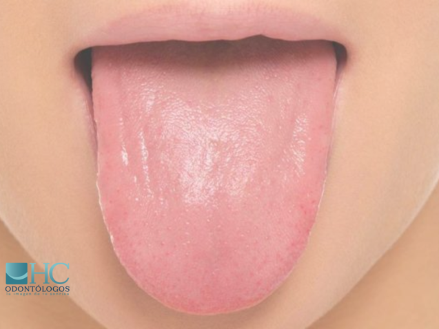 HC Odontólogos | Clínica Dental en Mérida Yucatán
