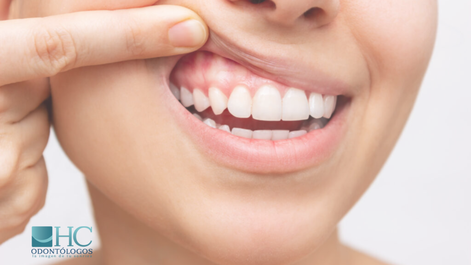 ¿Cómo saber si mi boca está sana? - HC Odontólogos | Clínica Dental en Mérida Yucatán
