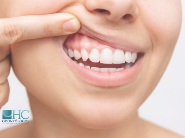 ¿Cómo saber si mi boca está sana? - HC Odontólogos | Clínica Dental en Mérida Yucatán