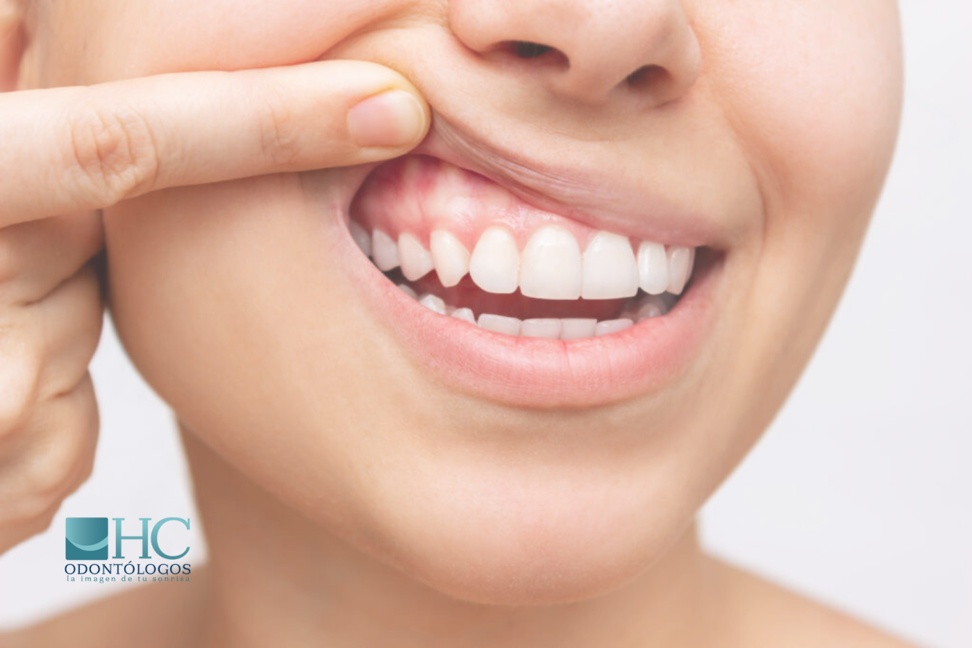 ¿Cómo saber si mi boca está sana? - HC Odontólogos | Clínica Dental en Mérida Yucatán